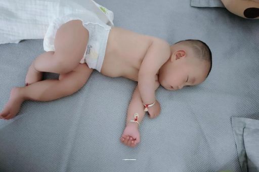 昭通六个月宝宝眼睛散光